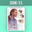 Плакат «Дисфункция височно-нижнечелюстного сустава» (ЗОЖ-33, ламинированная бумага, А2, 1 лист)